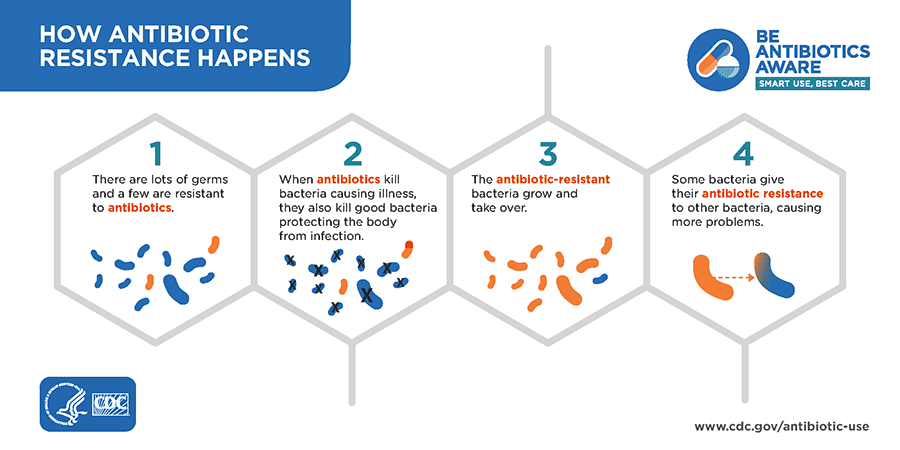 When do I need an antibiotic? Bacterial vs. Viral Infections